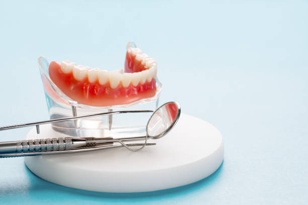 Dental Bonding in Payson, IL